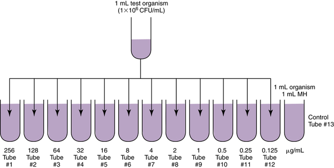 Urinalysis Laboratory | Basicmedical Key