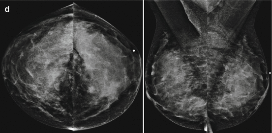 Overview Of Radiologic Quality Assurance And The Imaging Evaluation Of ...