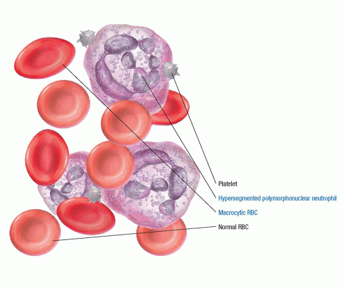 Hematologic Disorders | Basicmedical Key