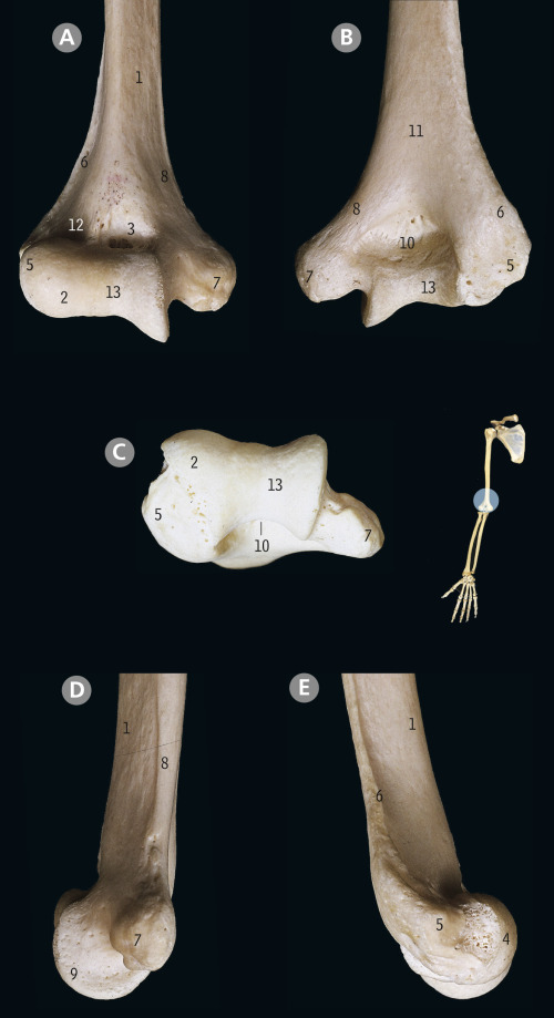 Upper Limb | Basicmedical Key