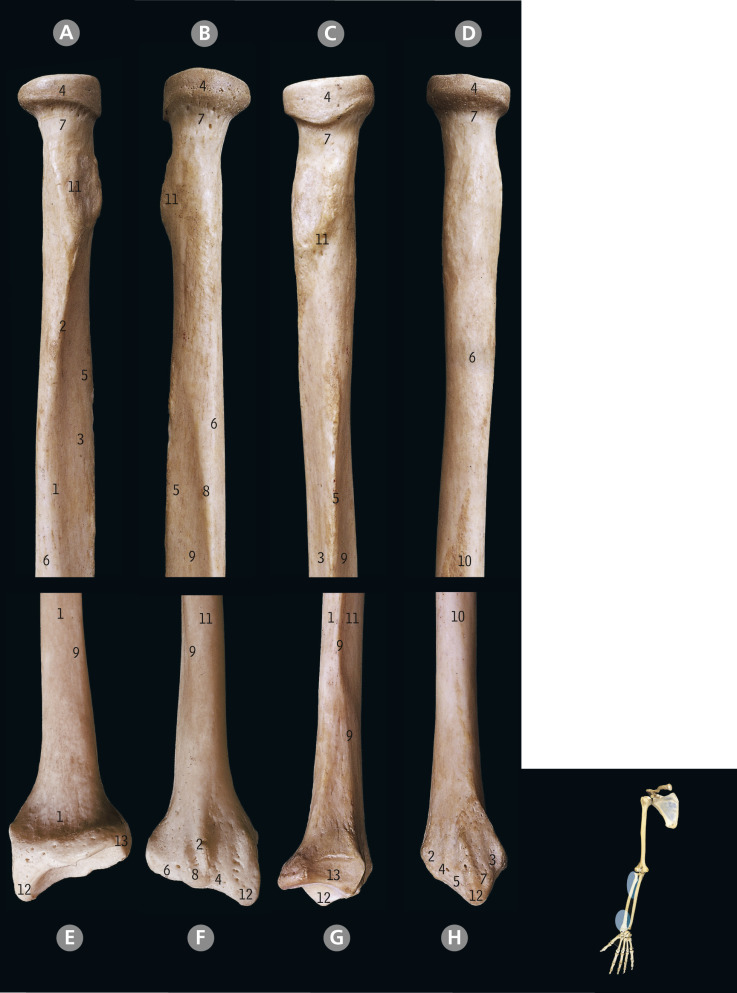 Upper Limb | Basicmedical Key