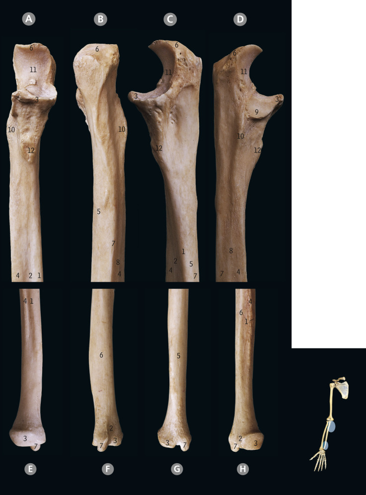 Upper Limb | Basicmedical Key