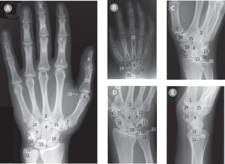 Upper Limb | Basicmedical Key