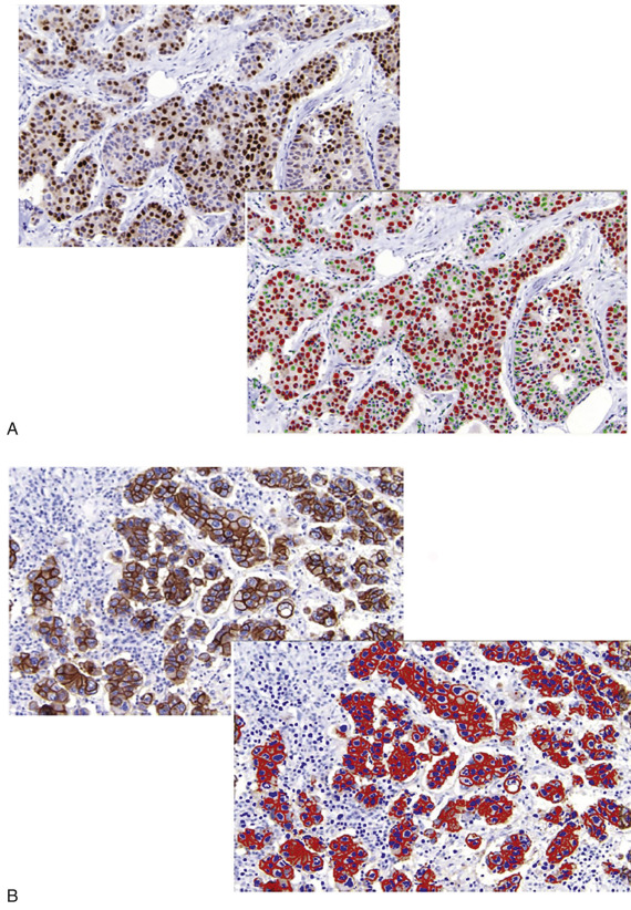 Imaging And Quantitative Immunohistochemistry | Basicmedical Key