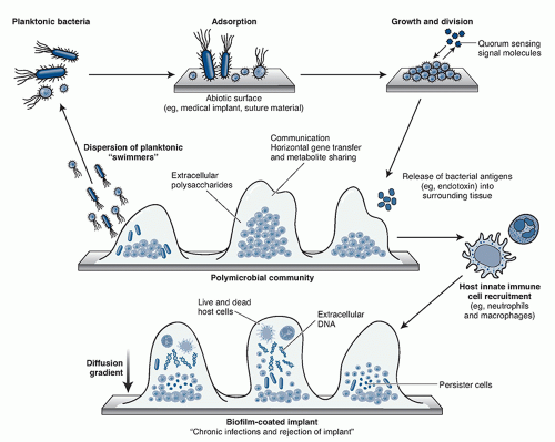 Biofilm And Biofilm Control | Basicmedical Key