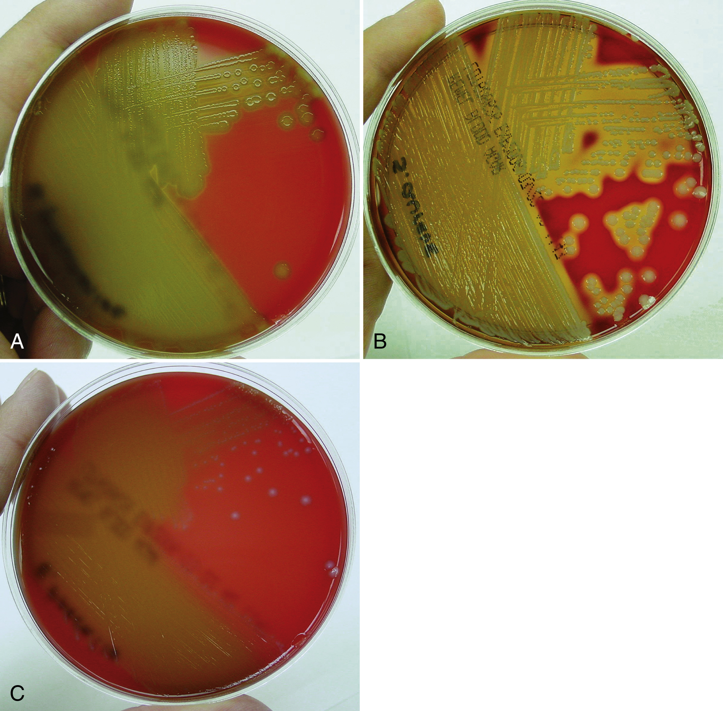 A Primer On Microbiology | Basicmedical Key