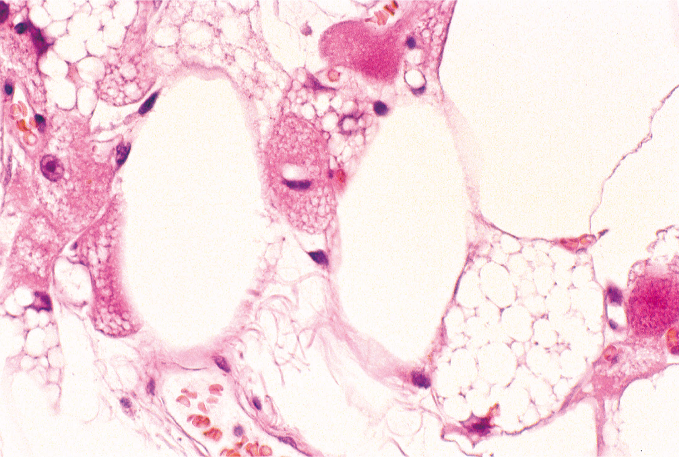 A microscopic view exhibits two large oval structures with dark nuclei and fibrous surroundings under a microscope, accompanied by smaller round cells.