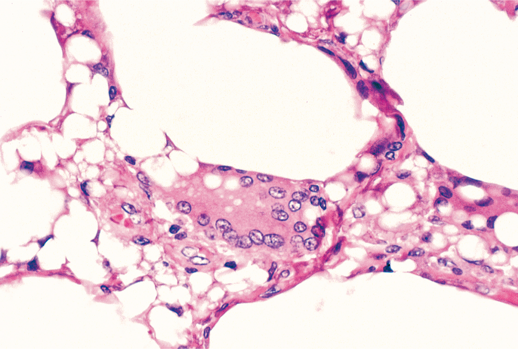 A microscopic view exhibits large oval structures with dark nuclei and fibrous surroundings under a microscope, accompanied by numerous smaller round cells.