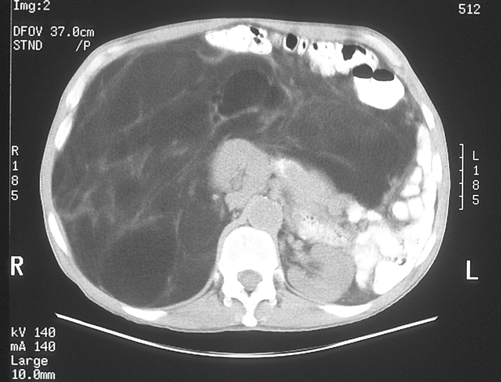 A computed tomography scan shows a cross-sectional view with labeled right and left sides, a scale in centimeters, and visible internal structures for anatomical reference.