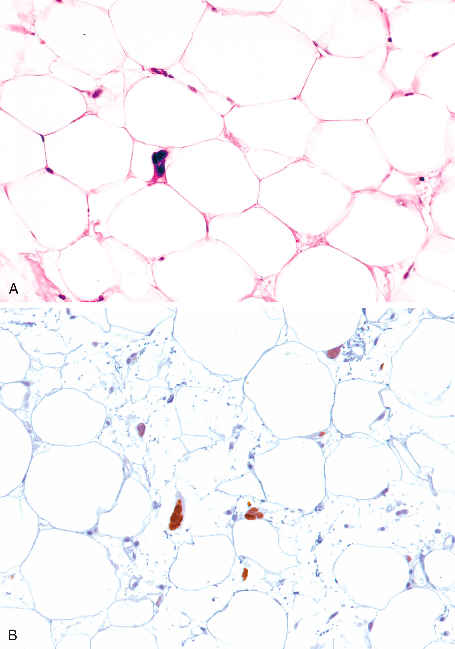 A panel of two microscopic views features round cells with dark nuclei under a microscope, with A displaying dense packing and B displaying scattered nuclei.