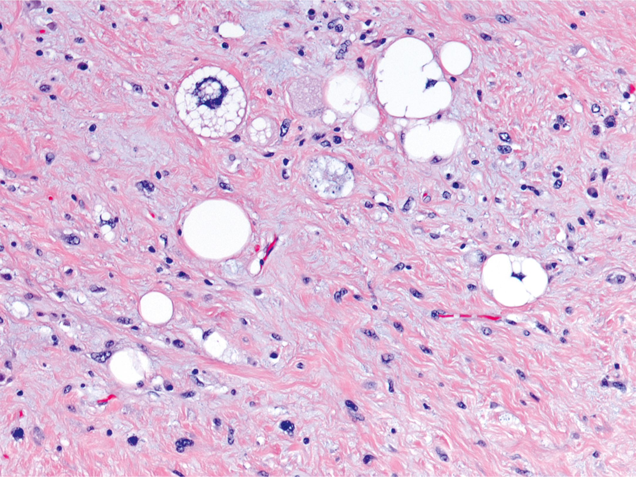 A microscopic view presents a tissue sample containing multiple circular structures of varying sizes scattered throughout, with some structures appearing more prominent and others smaller.