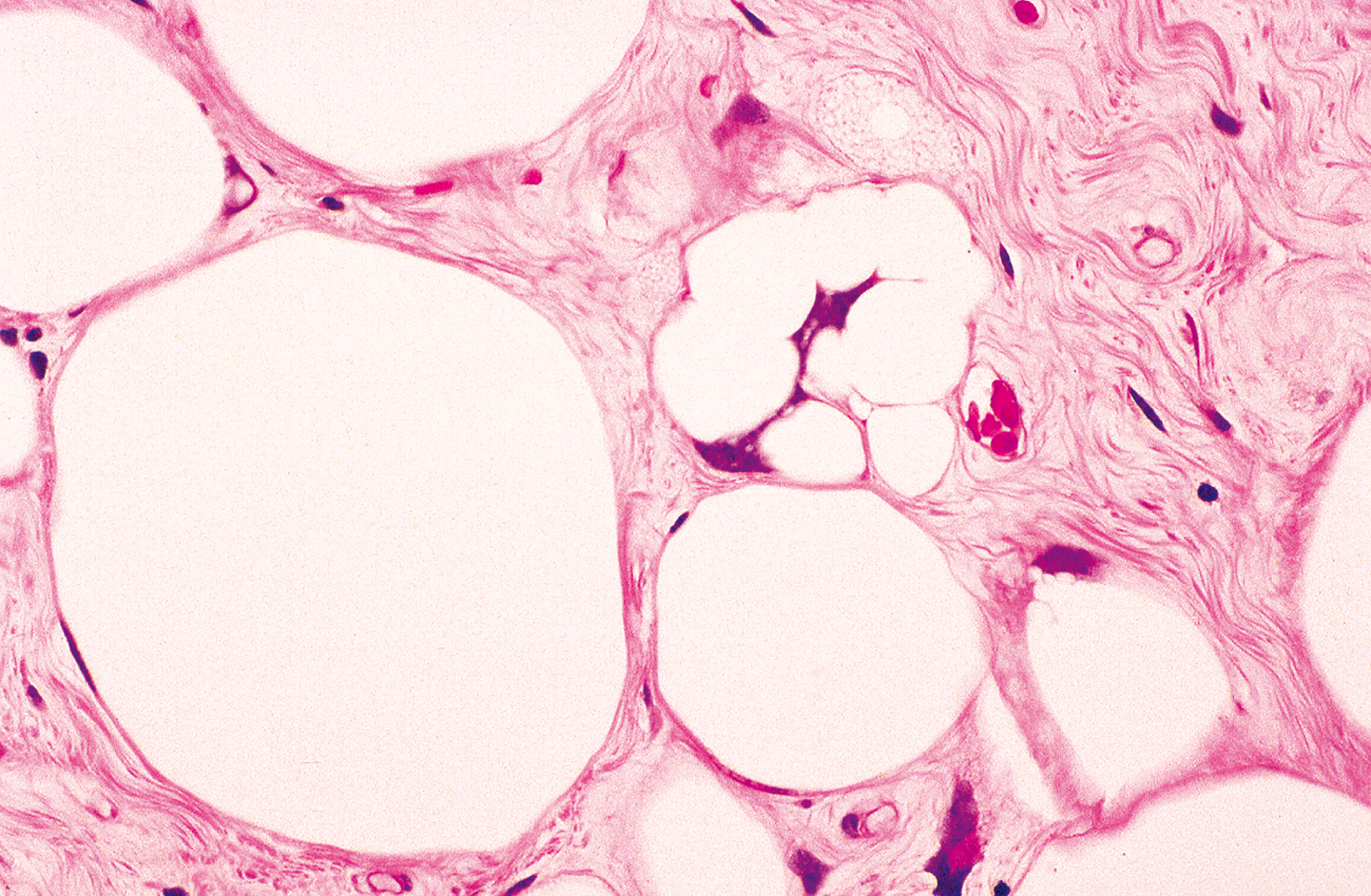A microscopic view presents a tissue sample with several large circular structures and a central clustered area containing smaller circular forms, all connected by a fibrous network.