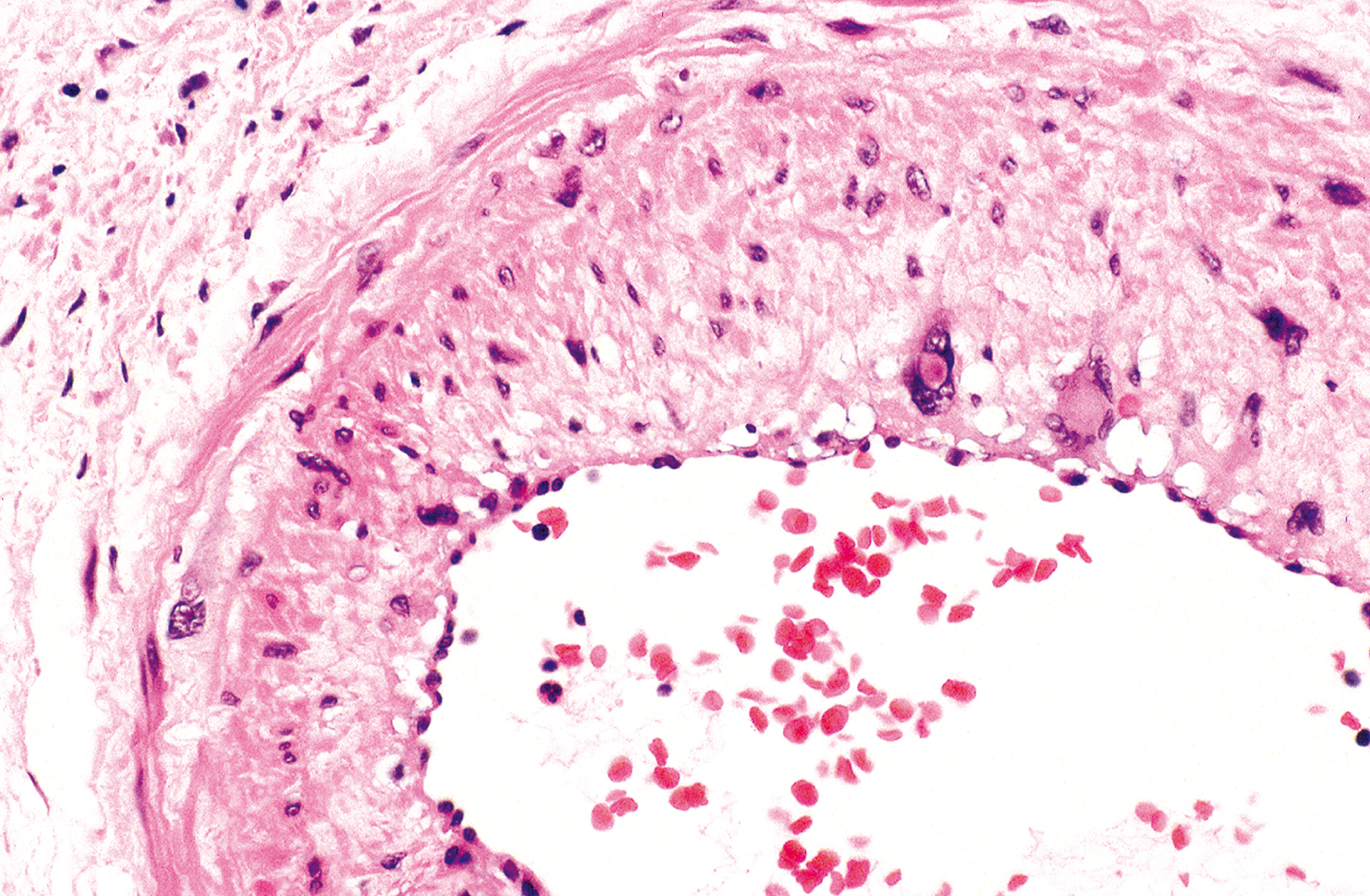 A microscopic view presents a tissue sample with a curved fibrous layer, scattered cells, and a central area containing multiple small circular structures.