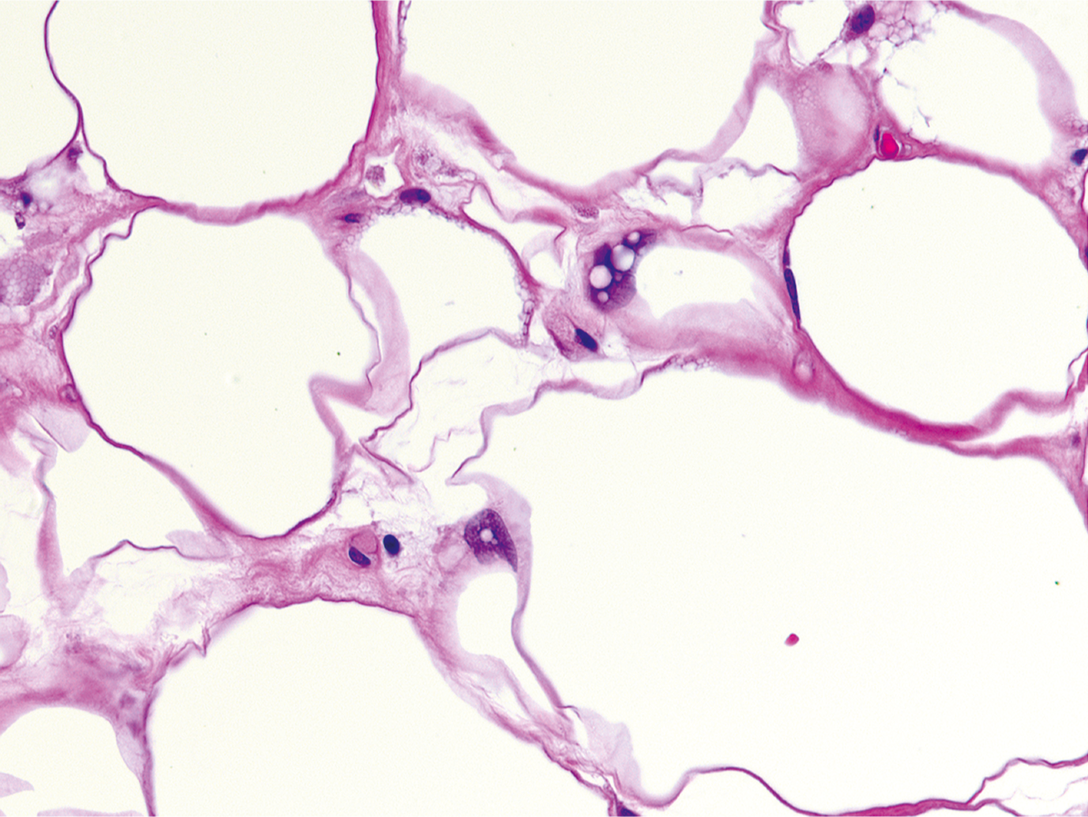 A microscopic view presents a tissue sample with several large circular structures connected by a network of fibrous strands and scattered small circular forms.