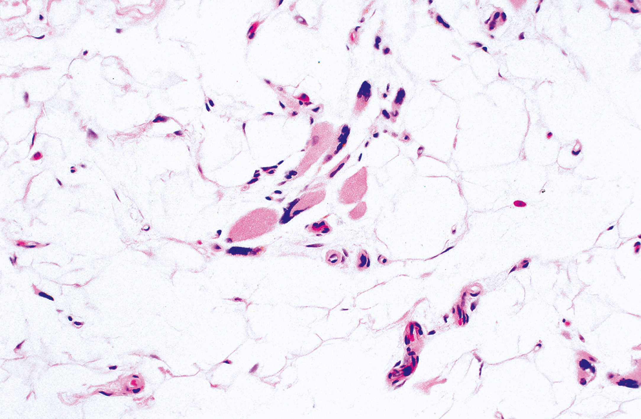 A microscopic view presents a tissue sample with a network of fibrous strands and scattered irregular shapes of varying sizes.