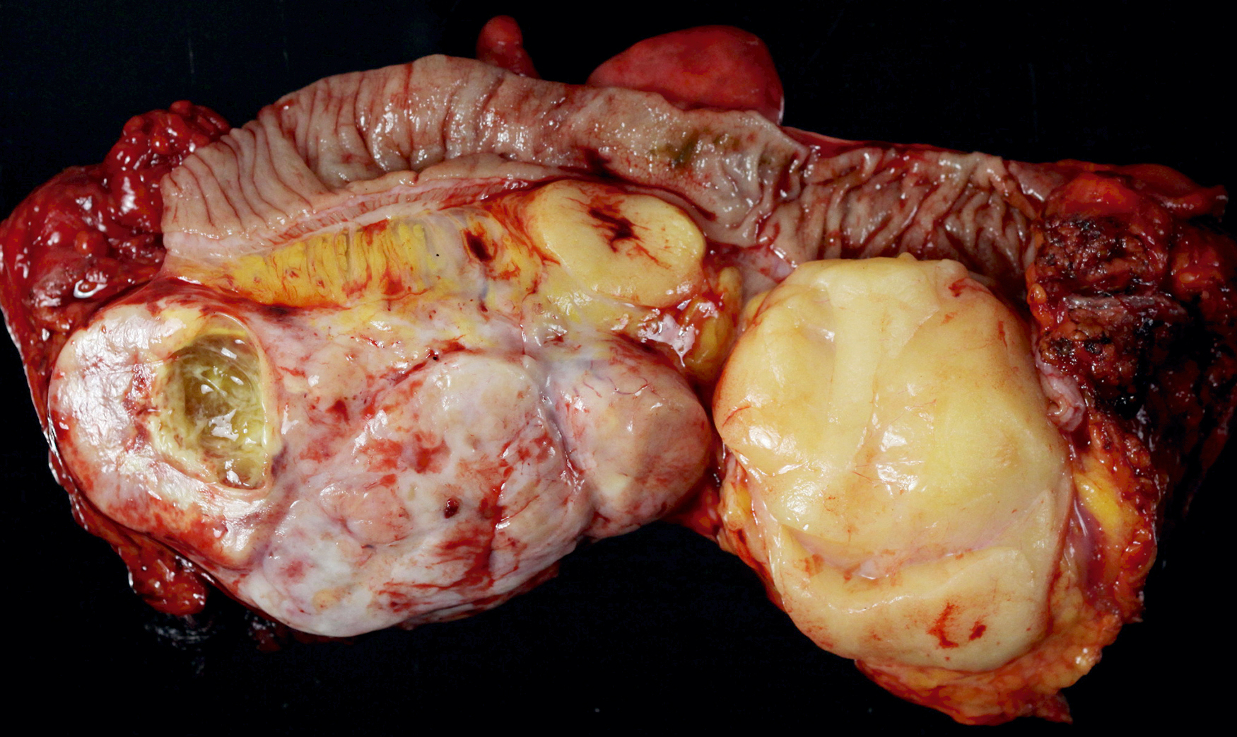 A photo presents a specimen with a tubular structure, a large rounded mass, and an irregular surface with multiple openings.