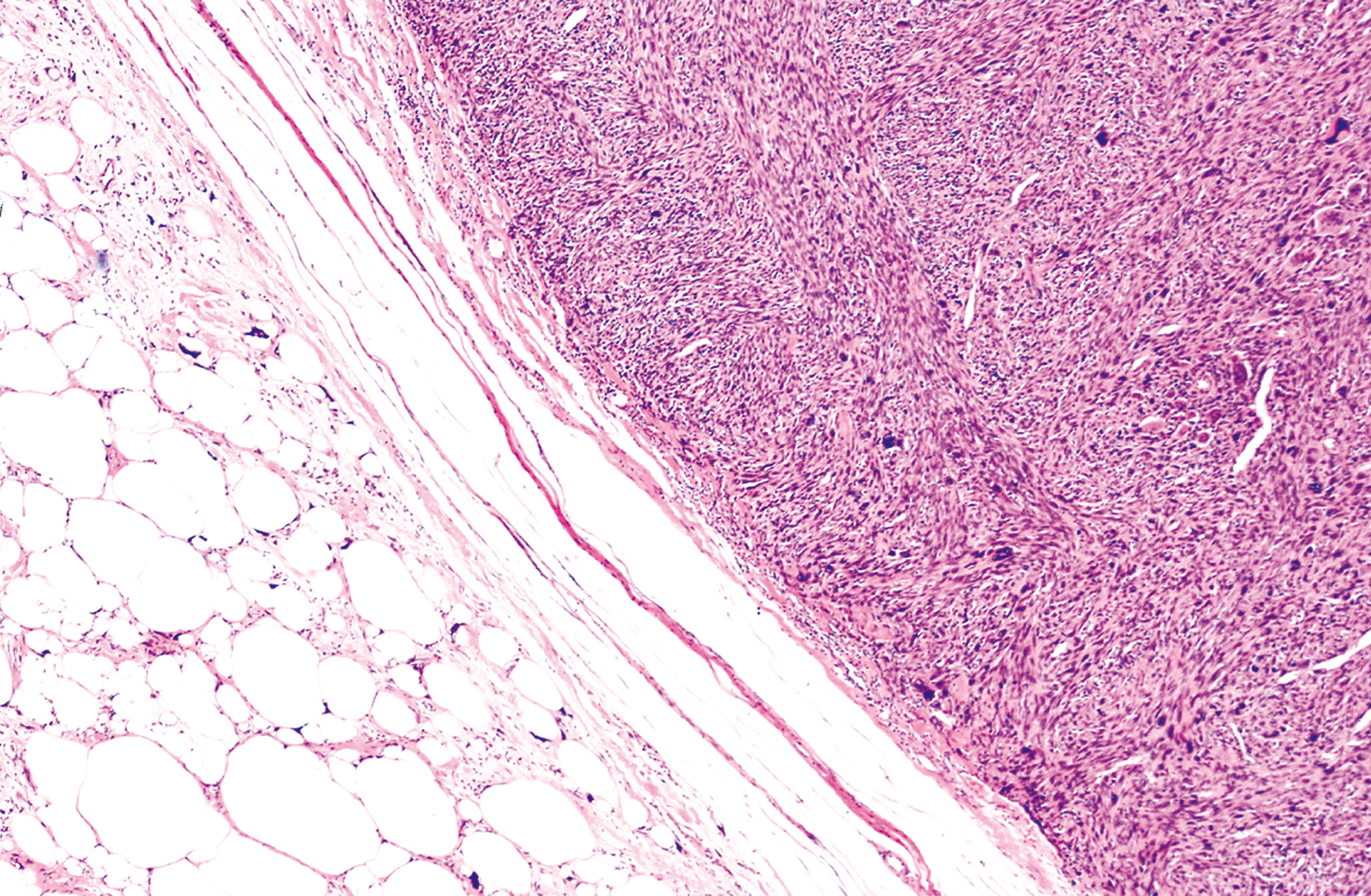 A microscopic view presents a tissue sample with a layered structure, one side featuring large circular forms and the other side containing a dense cellular arrangement.