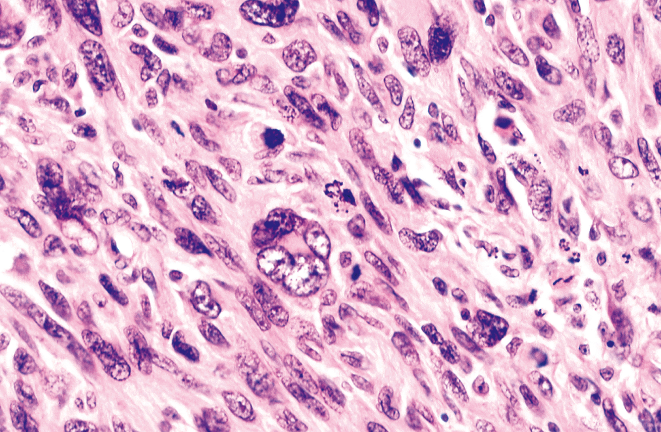 A microscopic view presents a tissue sample with a dense network of cells and several irregular circular structures scattered throughout.