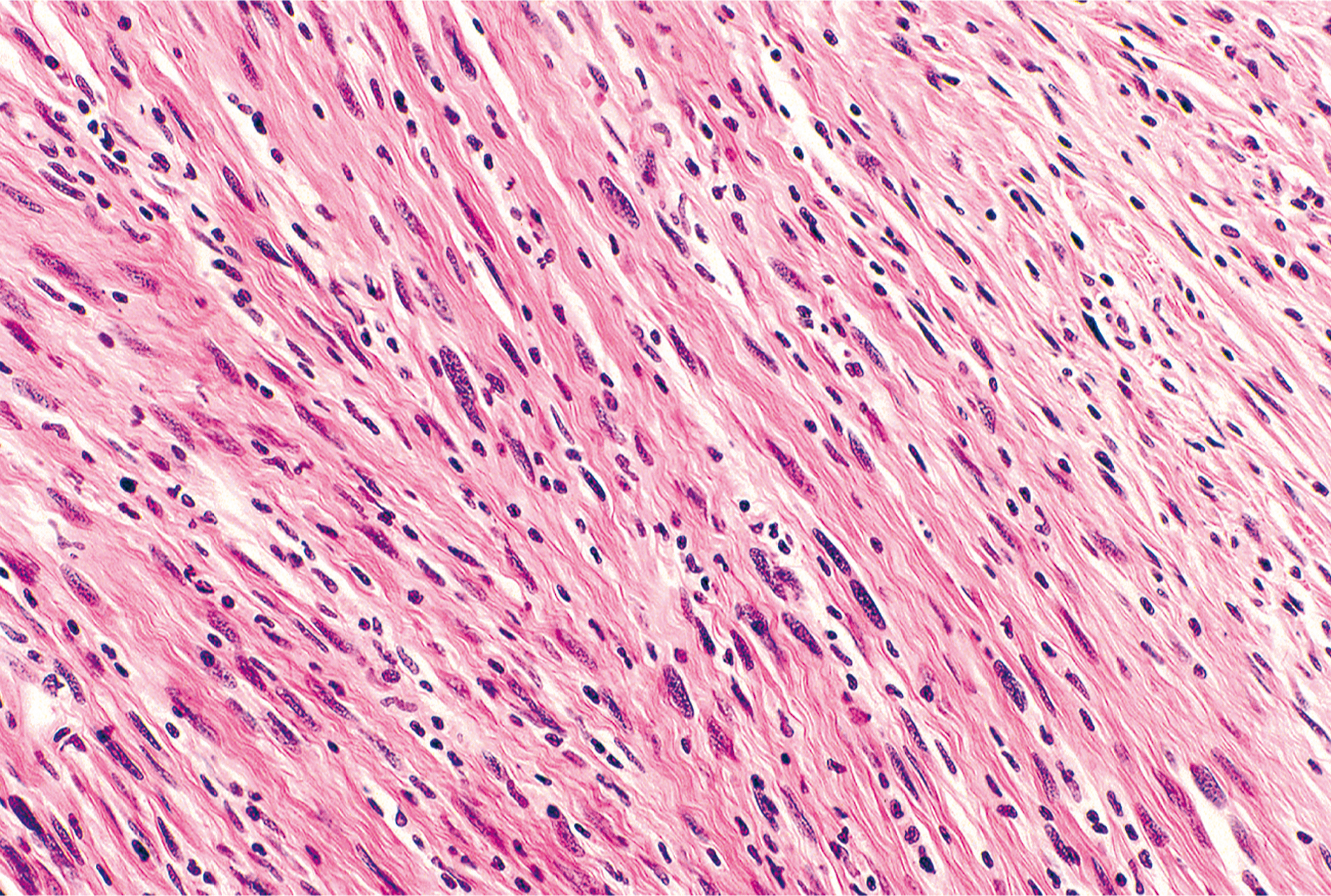 A microscopic view presents a tissue sample with a network of fibrous strands and scattered cells of varying sizes throughout it.