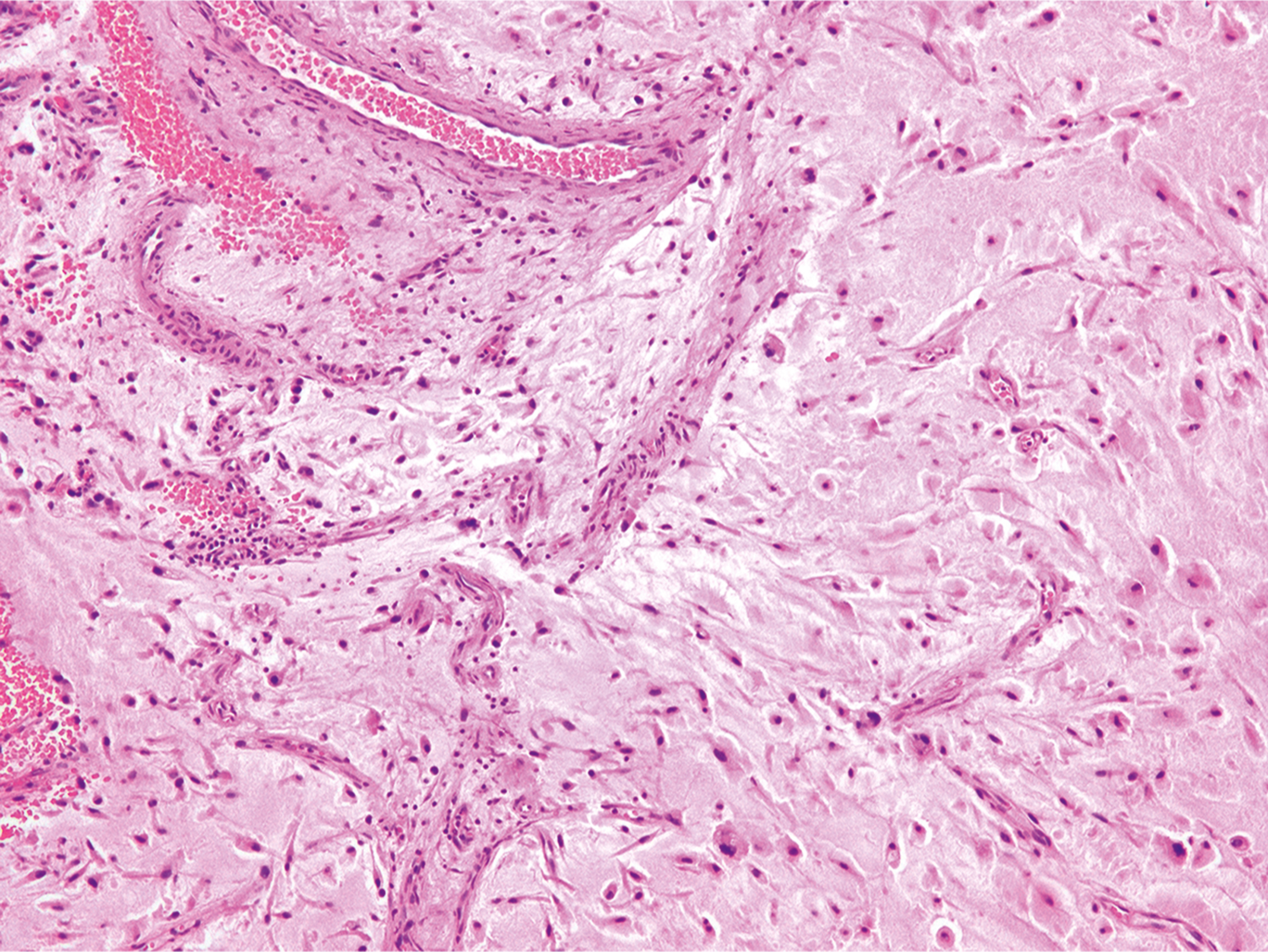 A microscopic views exhibits elongated cells with dark nuclei and fibrous structures under a microscope, with a wavy pattern across the field.