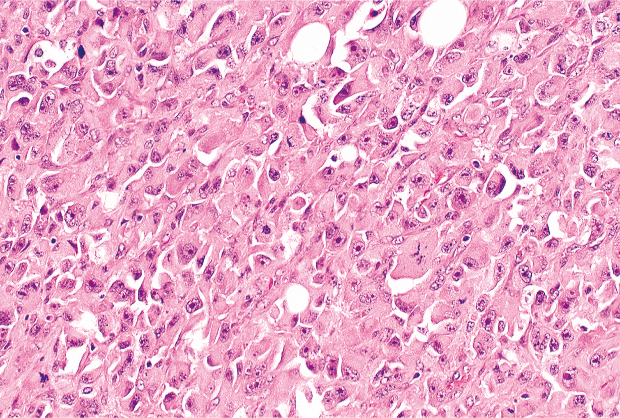 A microscopic view exhibits elongated cells with dark nuclei and fibrous structures under a microscope, with a dense and uniform pattern.