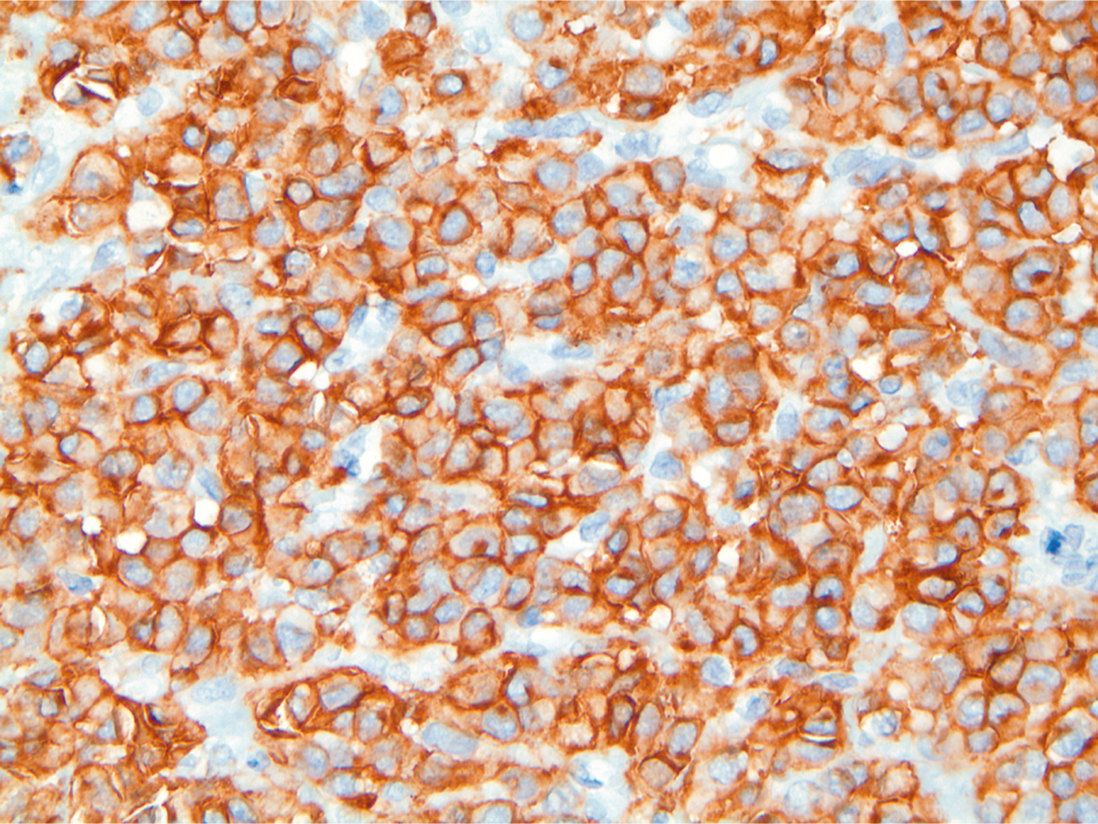A microscopic view shows the thin, dark brown edges of each cell. The cells are round to oval with the inside of the cell lighter.