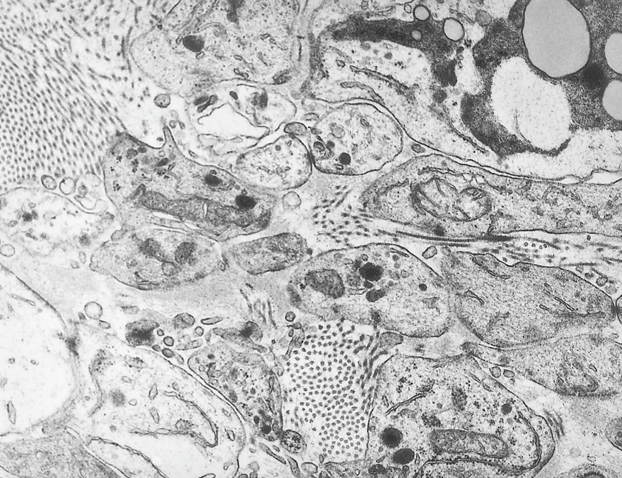 An electron micrograph shows small, dark granules within the cells, resembling dense-core neurosecretory granules, along with fine, thread-like microtubules appearing as thin, straight lines.