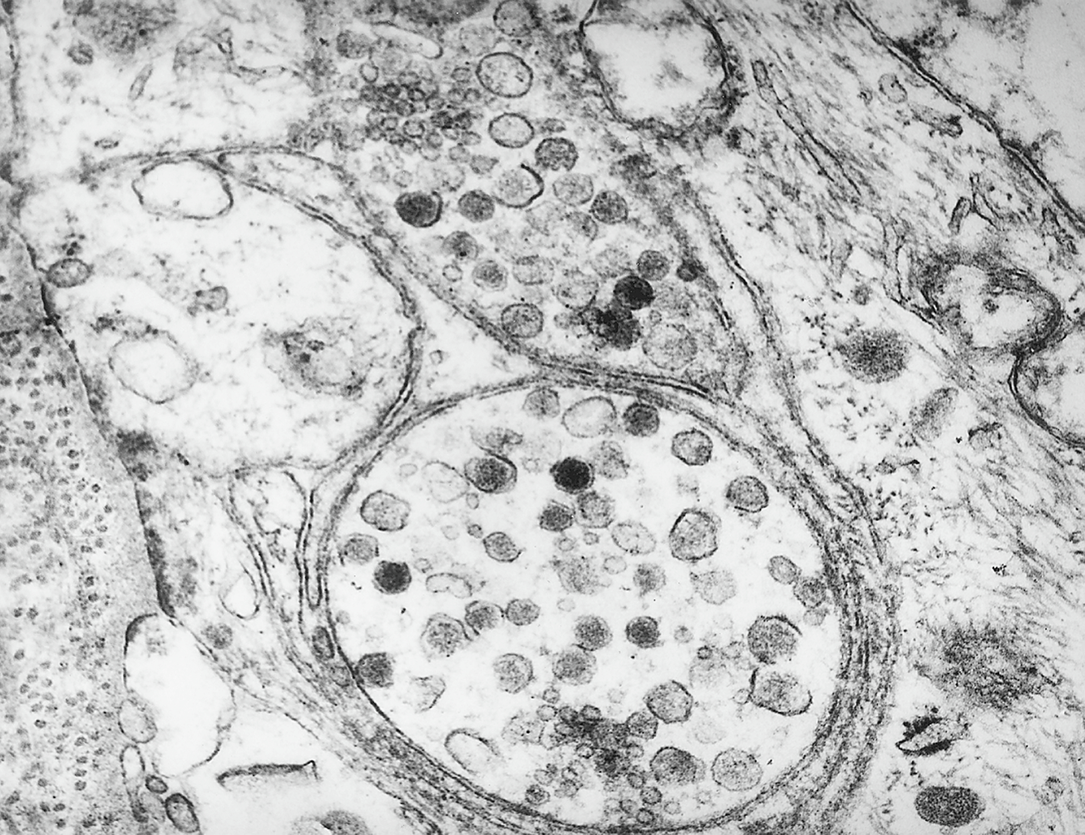 An electron micrograph shows synapse-like structures with small, dark neurosecretory granules and vesicles inside the cells, appearing as dense dots. A portion of a neurite extends from the cell.