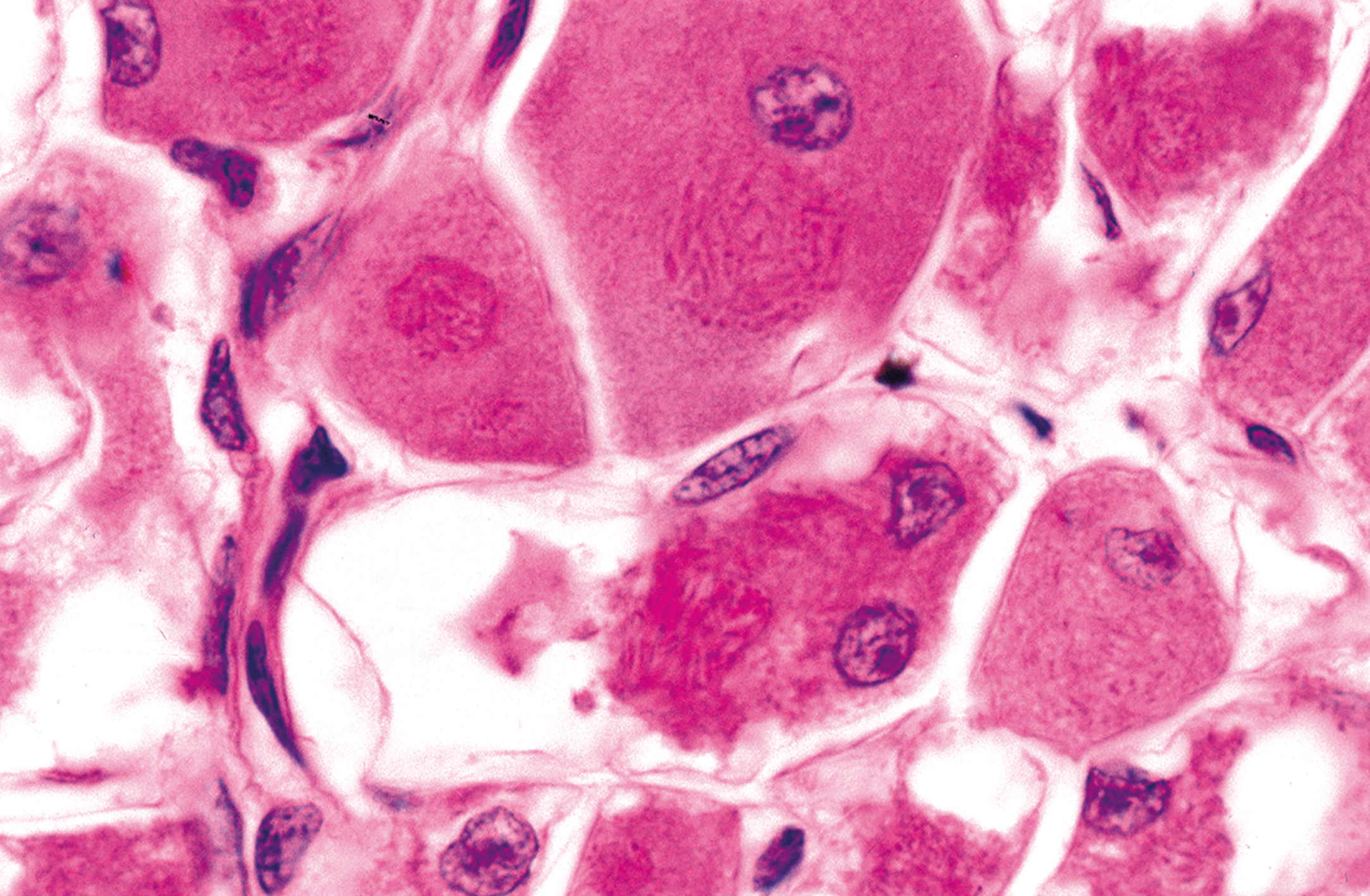 A detailed view of polygonal cells showing prominent intracellular crystalline structures resembling organized filamentous material.