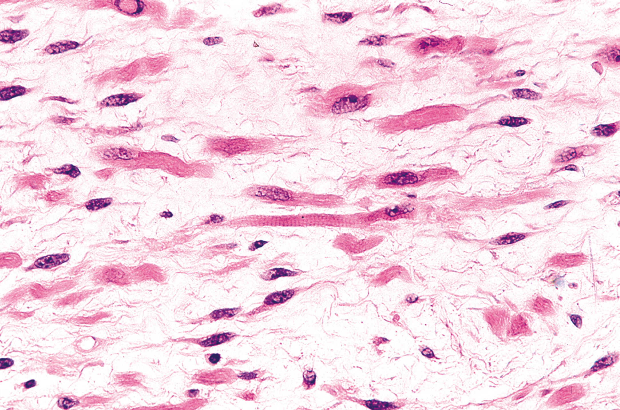 A microscopic view of tissue with spindle-shaped cells, oval nuclei, and thin fibrous structures scattered against a uniform background.