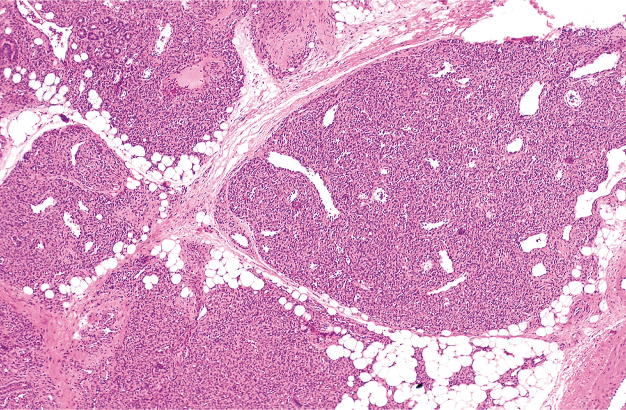 A microscopic section with multiple lobules separated by fibrous septa, and each lobule contains central blood vessels.