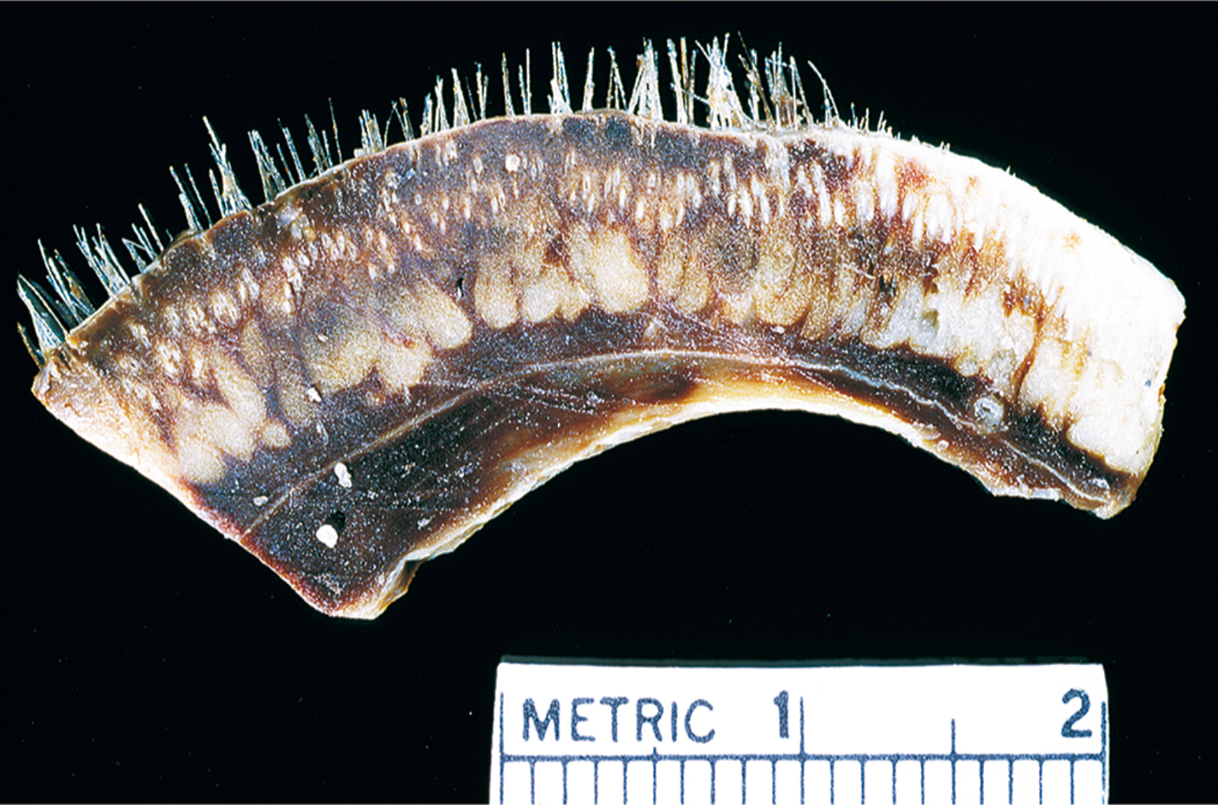 A curved section of scalp with multiple hair follicles and dark irregular areas placed above a metric scale ranging from zero to two centimeters.
