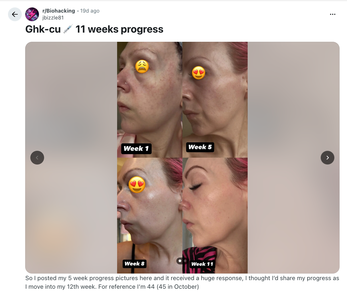 does ghk-cu work orally Before and After: The Real Timeline, Benefits, Dosage & 2026 FDA Status Get Vitamin B12 Injectable